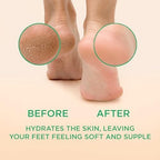 Lee Beauty 8oz Professional Gel Callus Remover - Image 2