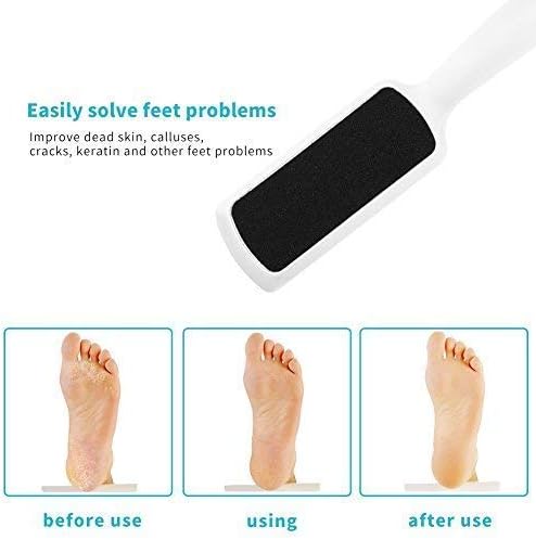 Foot File for Dead Skin - Image 4