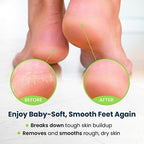 FOOT CURE Exfoliator & Callus Remover Pedicure Set – Care Kit Includes File - Image 9
