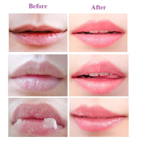 2PCS Bee Balm Honey Pot, Propolis Moisturizing Lip Mask, Hydrating & Prevention - Image 3