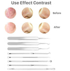 Pinkiou Blackhead Remover Comedone Pimple Popper Tool Acne Extractor Blemish - Image 6