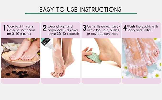 Karlash Callus Remover Gel for Feet and Foot Pumice Stone Scrubber Kit Remove - Image 3