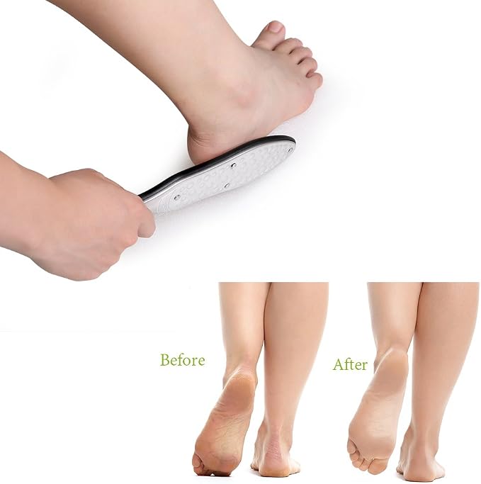 BEZOX Professional Foot File Callus Remover, Double Sided Pedicure Rasp - Image 4