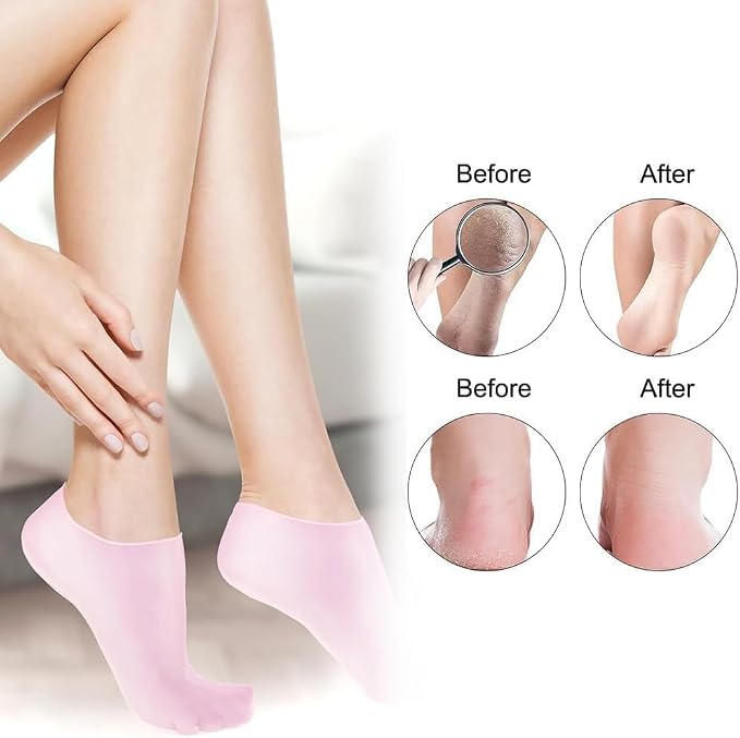 6 Pairs Silicone Socks for Dry Cracked Feet - Image 6