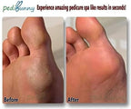 Electric Foot Callus Remover - Image 6