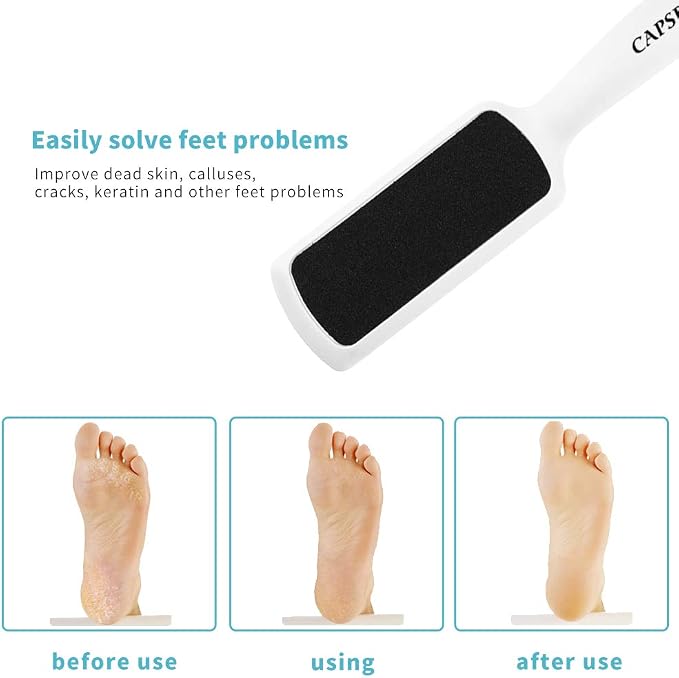 Pedicure Foot Rasp File Callus Remover, Double-Sided Colossal Foot Rasp Foot - Image 4