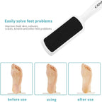 Pedicure Foot Rasp File Callus Remover, Double-Sided Colossal Foot Rasp Foot - Image 4