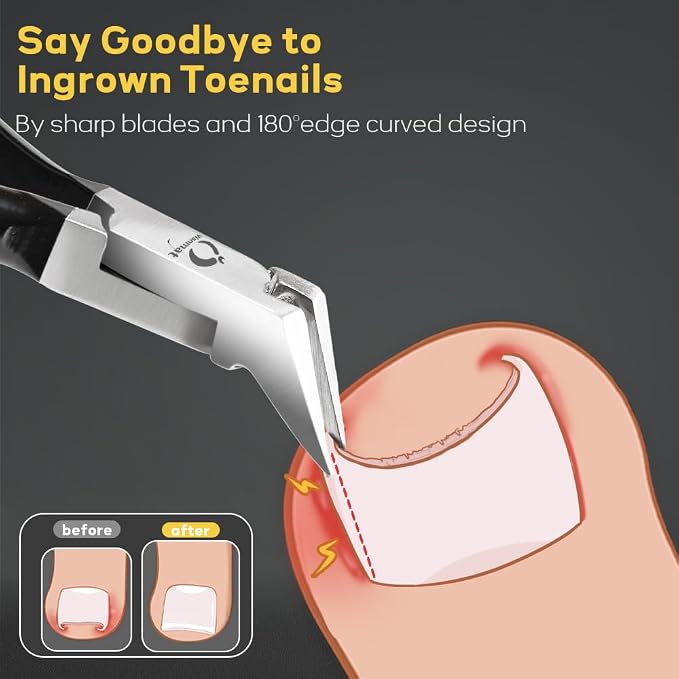 Wanmat Toenail Clippers, Professional Thick & Ingrown Nail Clippers - Image 3