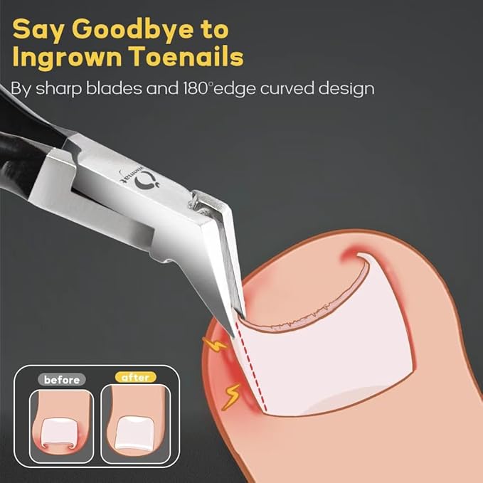 5 in 1 Professional Toenail Clippers - Image 3