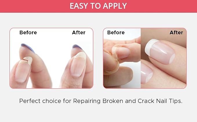 Professional Nail Repair Kit for Broken Cracked Split and Weak Nails. Easy to - Image 4