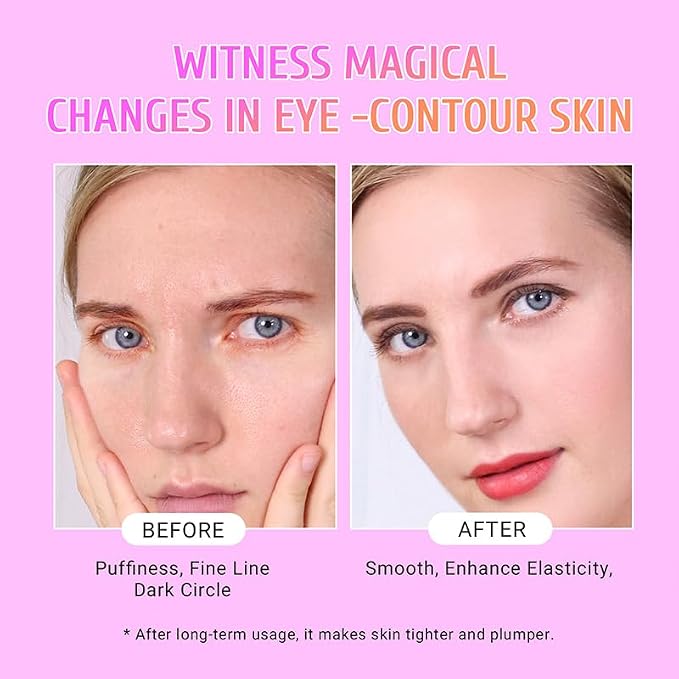 PEAUAMIE Under Eye Patches Gold and Hyaluronic Acid - Image 4
