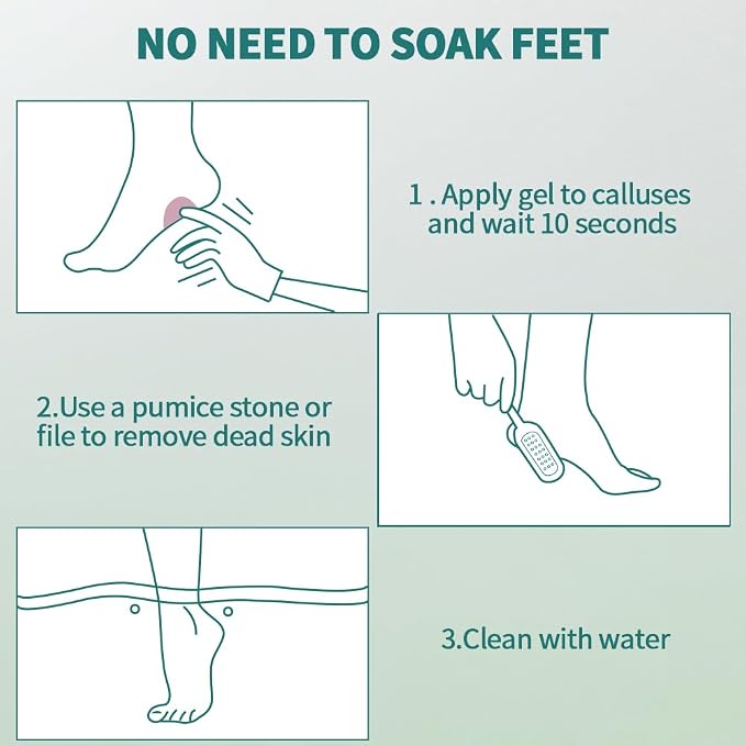 Gorgellux Callus Remover for Feet, Callus Remover Gel & Foot File Kit, Foot - Image 7