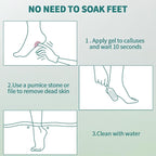 Gorgellux Callus Remover for Feet, Callus Remover Gel & Foot File Kit, Foot - Image 7