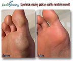 Electric Callus Remover for Feet - Image 5