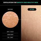 Dermasuri - Deep Exfoliating Back Scrubber - Bath & Shower Back Scrub - Body - Image 3
