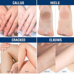 OUKEYA Urea Cream 40 Percent, Foot & Hand Cream - Image 9