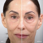 Dr. Tree 24kt Gold Collagen Hydrogel Eye Patches, - Image 5