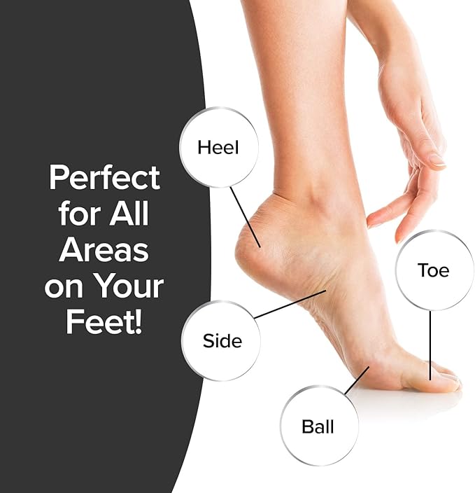 PedEgg Foot File – Traps Shavings Inside - Image 7
