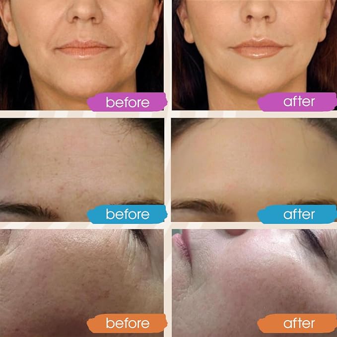 GLEOW New 2024 Pure Hyaluronic Acid Serum - Image 3