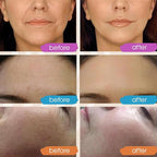 GLEOW Retinol Serum for Face - Image 3
