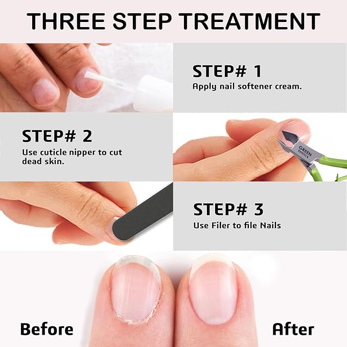 Professional Cuticle Trimmer Nail Cuticle Cutter Stainless Steel Cuticle Nippers - Image 4
