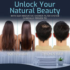 Mist Shower Filter Head for Hard Water Improves Skin, and Nails - Image 3