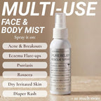 Pure Relief Rescue Spray for Sensitive, Irritated & Blemish-Prone Skin – - Image 2