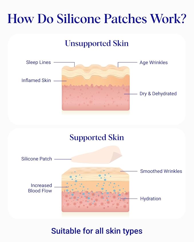 Wrinkles Schminkles Under Eye Wrinkle Starter Pack - Image 5