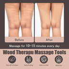 Wood Therapy Massage Tools for Body Sculpting, Lymphatic Drainage Massager - Image 3