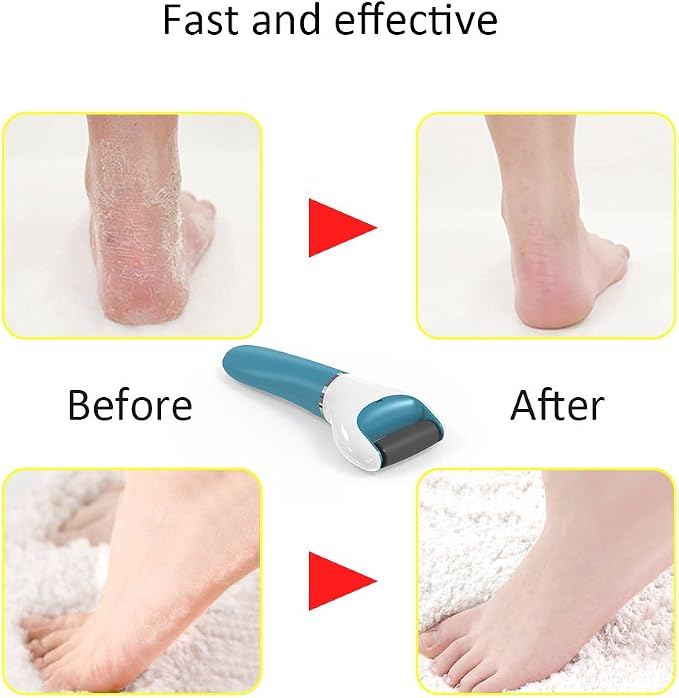 Electric Foot File Callus Remover Professional, 2-Speed Rechargeable Pedicure - Image 3