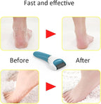 Electric Foot File Callus Remover Professional, 2-Speed Rechargeable Pedicure - Image 3