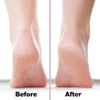 Probelle Double Sided Multidirectional Nickel Foot File Callus Remover - Image 4