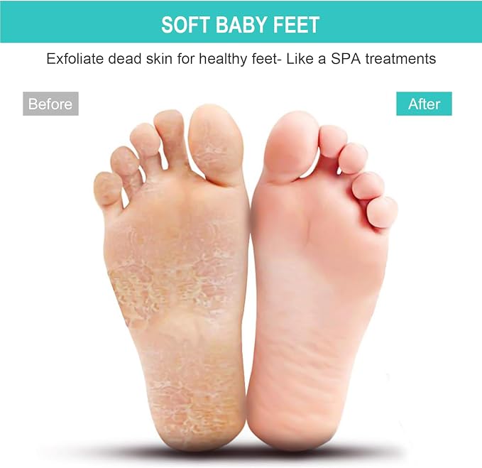 BESKAR XL Large Foot Scrubber Mat - Image 4