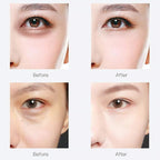Under Eye Patches, 30 pairs Hyaluronic Acid Anti-Aging Under Eye Mask, Collagen - Image 5