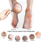 Pumice Stone Foot File, Wooden Handle Foot Scrubber & Callus Remover - Image 5