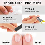 Professional Cuticle Trimmer Nail Cuticle Cutter Stainless Steel Cuticle Nippers - Image 8