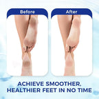 OUKEYA Urea Cream 42 Percent for Foot & Hand Cream - Image 5