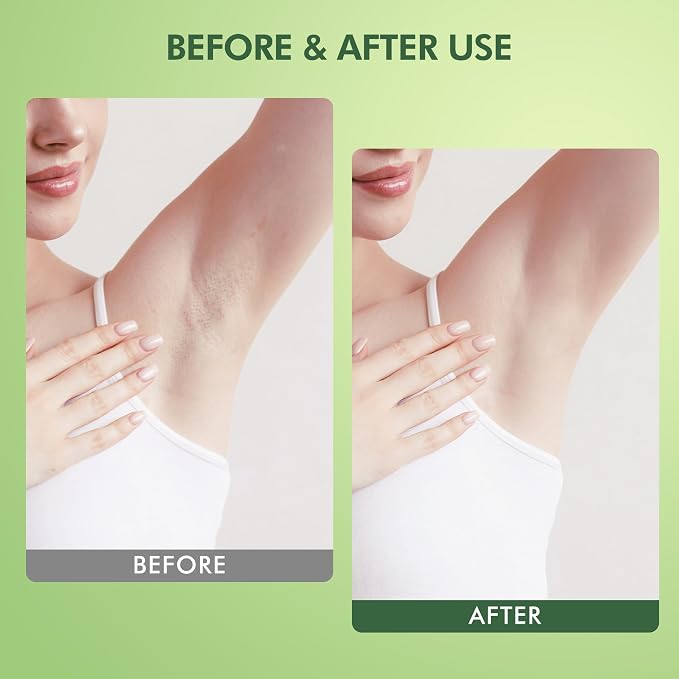 Armpit Detox and Scrub with Shea Butter and Coconut 8.82oz-Exfoliating Scrub - Image 4