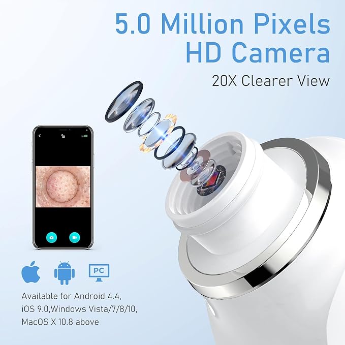 Facial Pore Blackhead Remover Vacuum, 1080P Camera Blackhead Remover, 20x Zoom - Image 2