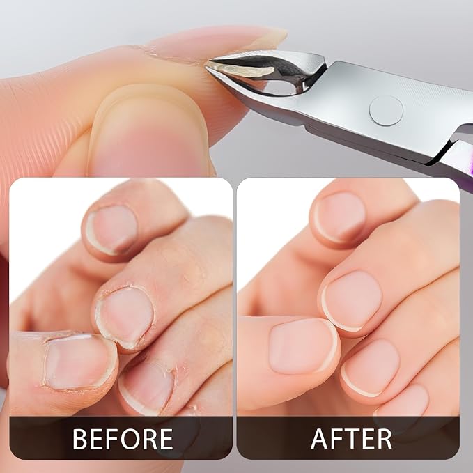 Cuticle Nippers Kit: Precision Nano-Coated Stainless Steel Cuticle Trimmer - Image 4