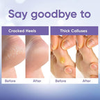 CÉLOR Foot Peeling Mask for Dry Cracked Feet | Foot Mask to Exfoliate Rough - Image 5