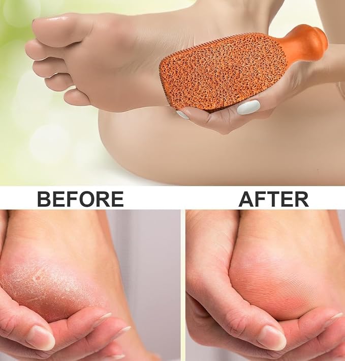 QUBA LINEN Pumice Stone for Feet - Image 3