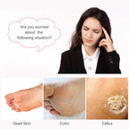 2-Pack 4 in 1 Pedicure Tool Callus Remover - Image 2