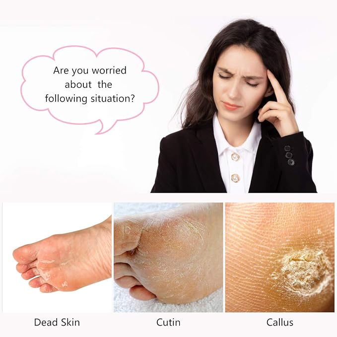 2-Pack 4 in 1 Pedicure Tool Callus Remover - Image 2