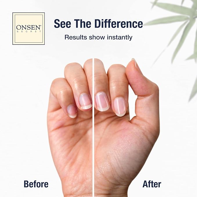 Onsen Secret Nail Care Kit - Image 2