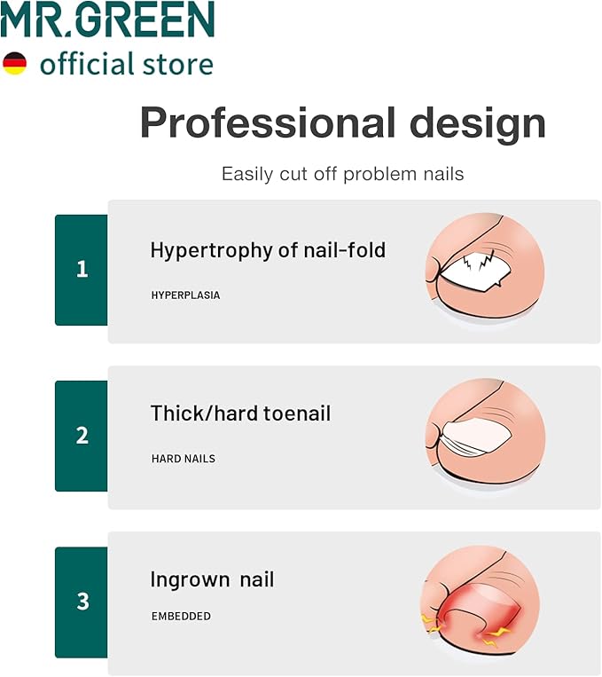 MR.GREEN Toenail Clippers Stainless Steel Ingrown Nail Cutter Thick and Hard - Image 3