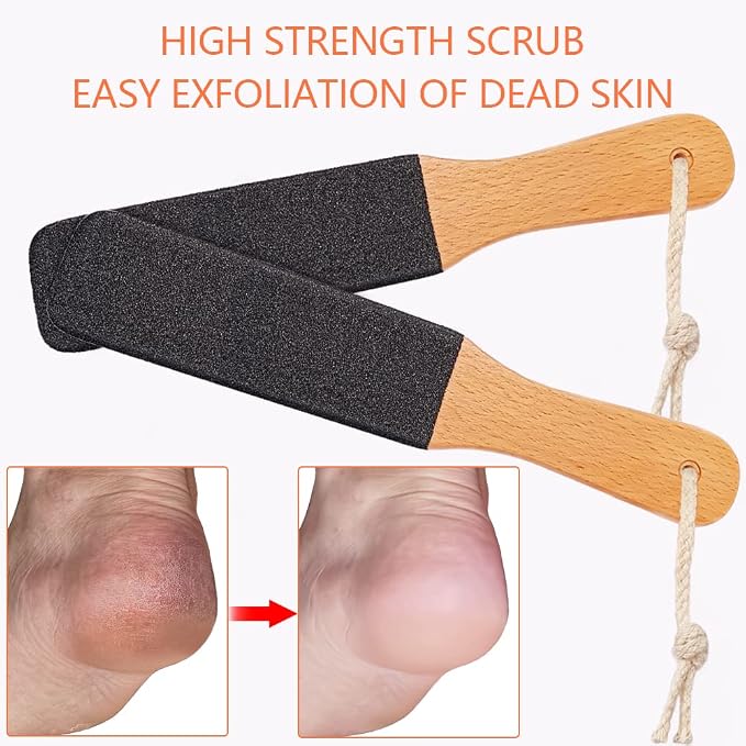 TOPMEET Foot File/Rasp, Exfoliator Pedicure Tool Foot Callus Remover Scrubber - Image 3