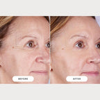 CurrentBody Skin LED Light Therapy Mask: Series 2 - Image 6