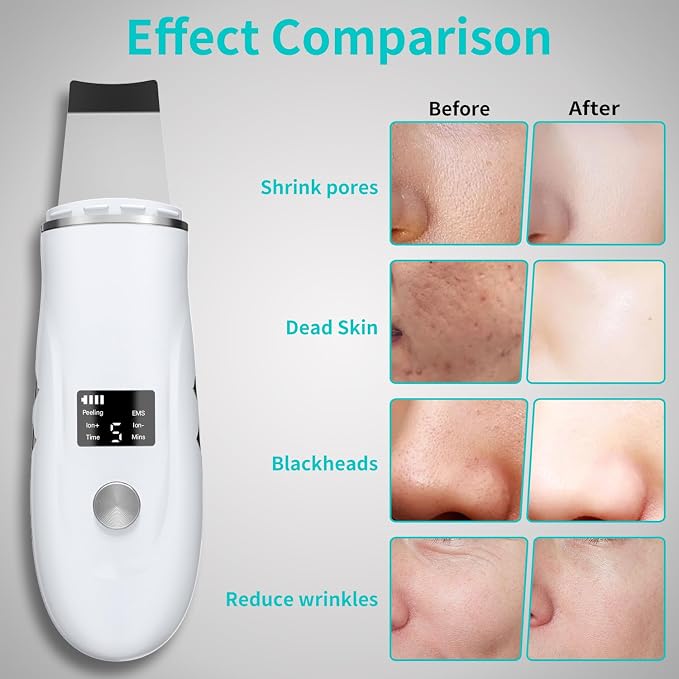Face Scrubber Skin Spatula - Image 3