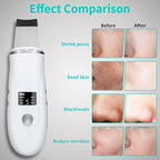 Face Spatula Blackhead Remover - Image 3